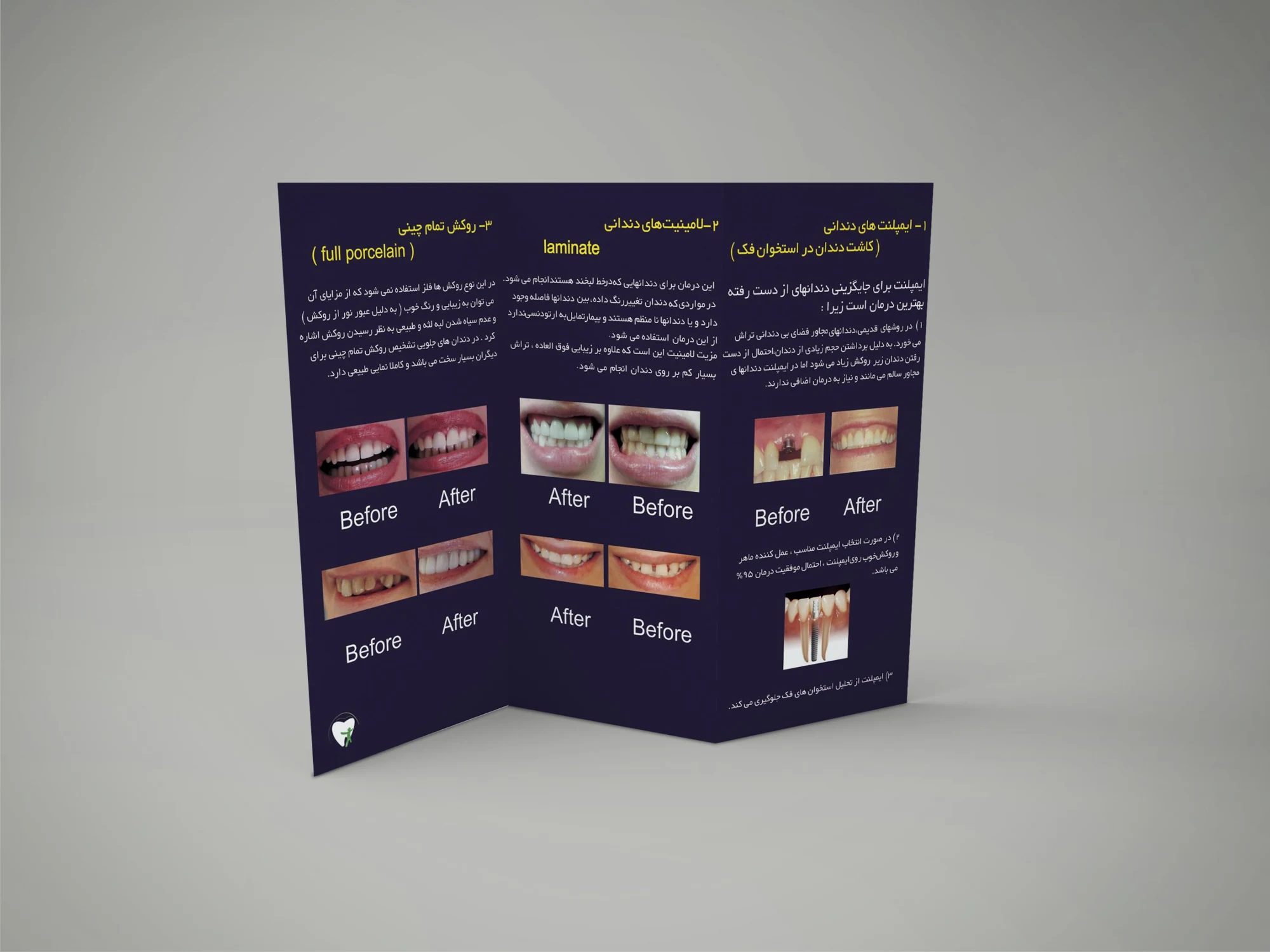 Advertising — 22